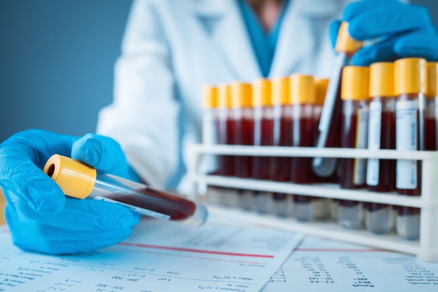 Blood markers — cholesterol, glucose, inflammation and hormone panels — that add a real-time layer to your genetic risk